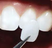 Example of dental materials