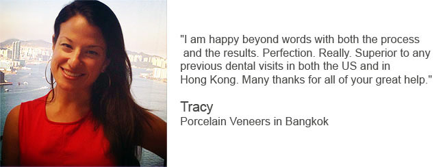 Thailand Dental Veneers Review - Tracy